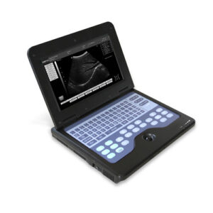 Ecógrafo de campaña cms600p2